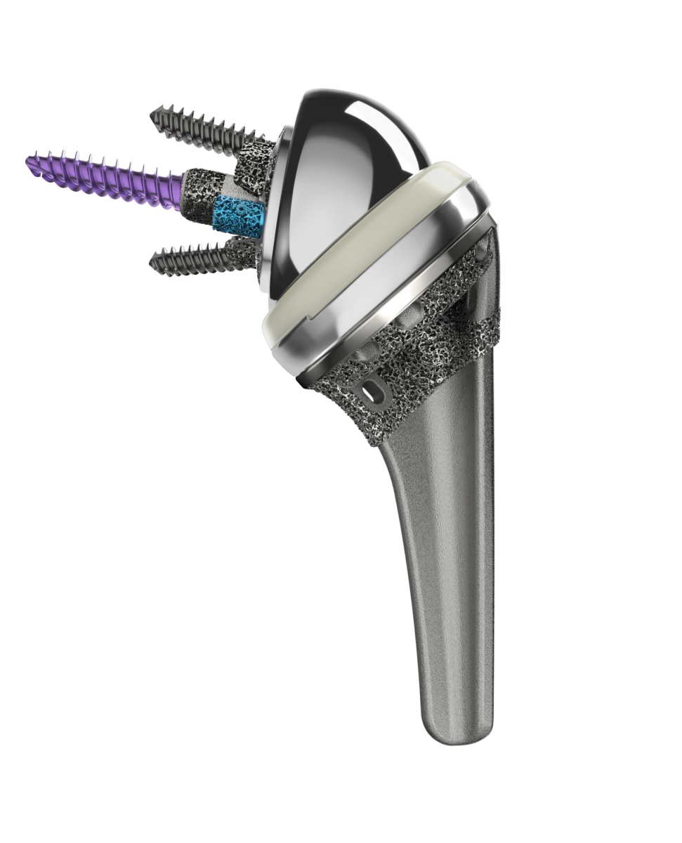 A picture of an implant from the INHANCE Shoulder System.
